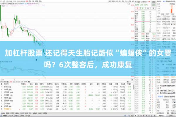 加杠杆股票 还记得天生胎记酷似“蝙蝠侠”的女婴吗？6次整容后，成功康复